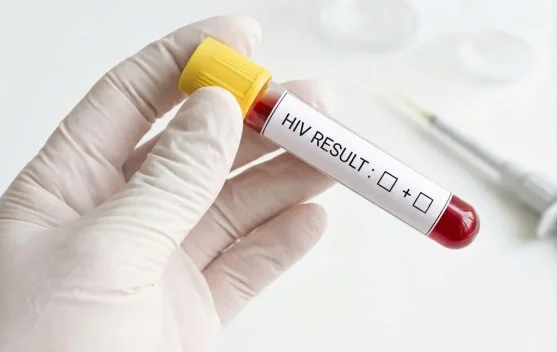 Stigma HIV di Samarinda: Kegagalan Kolektif dalam Deteksi Dini Kesehatan
